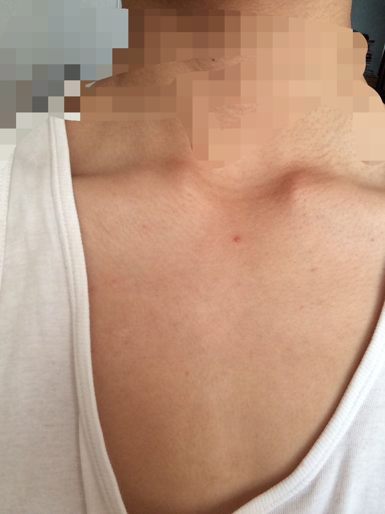 我这是不是发育不良啊01010101