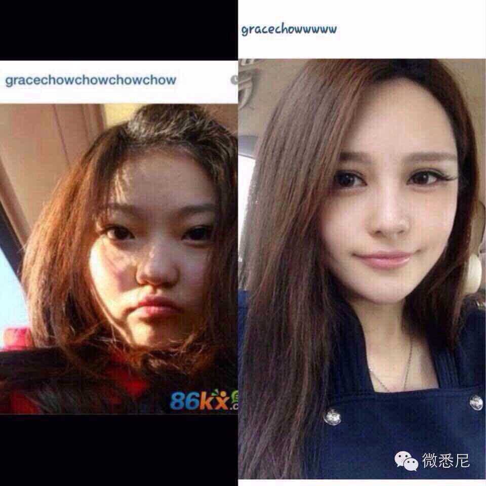 这是整容前后.谁知道这女的是谁,叫什么