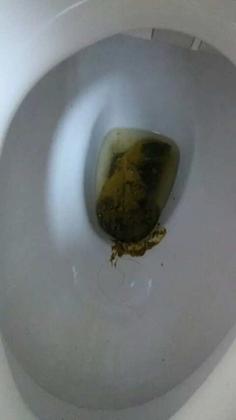 尝试一下拉裤子应该怎么做,女15,现已有便意但不明显,有两支开塞露