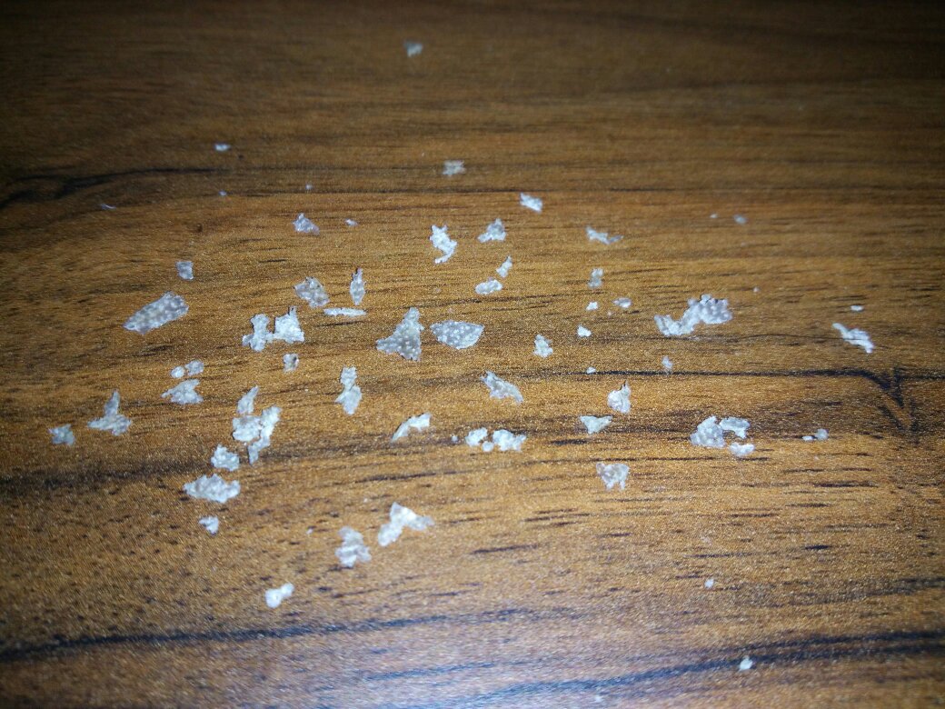 头皮屑一扣一大块,总什么洗洗头膏有效?(有实图,慎看)