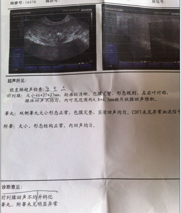 前列腺b超化验单