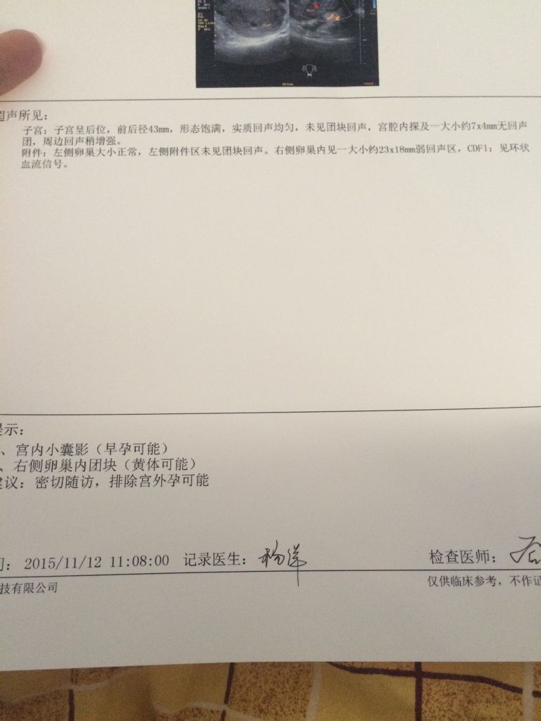 谢谢看得懂的解释一下,医生说可能宫外孕,黄体可能是什么意思?